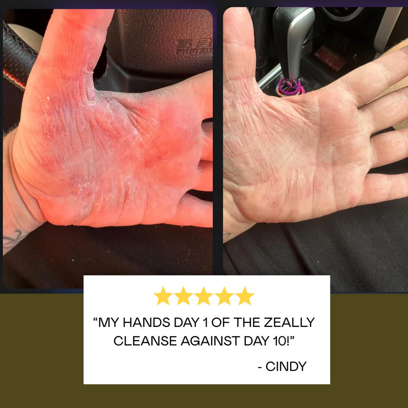 Zeally Herbs Intestinal Parasite Cleanse 60 caps